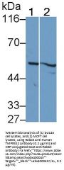 Transmembrane Protease, Serine 2 (TMPRSS2) Antibody
