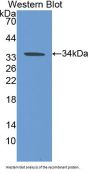 Carbonic Anhydrase VB, Mitochondrial (CA5B) Antibody