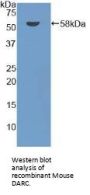 Atypical Chemokine Receptor 1 (ACKR1) Antibody