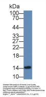 Fatty Acid Binding Protein 1, Liver (FABP1) Antibody