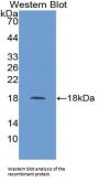 Fatty Acid Binding Protein 1, Liver (FABP1) Antibody