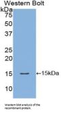 Fatty Acid Binding Protein 1, Liver (FABP1) Antibody