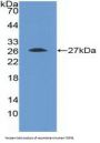 Fibroblast Growth Factor Receptor 4 (FGFR4) Antibody