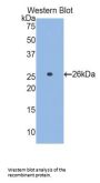 Glutamate Cysteine Ligase, Catalytic (GCLC) Antibody