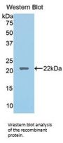Lecithin Cholesterol Acyltransferase (LCAT) Antibody