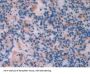 Lecithin Cholesterol Acyltransferase (LCAT) Antibody