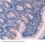 Lecithin Cholesterol Acyltransferase (LCAT) Antibody