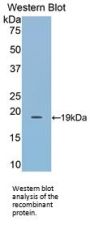 Lecithin Cholesterol Acyltransferase (LCAT) Antibody