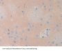 Lecithin Cholesterol Acyltransferase (LCAT) Antibody