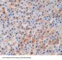 Lecithin Cholesterol Acyltransferase (LCAT) Antibody