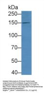 Nitric Oxide Synthase, Endothelial (NOS3) Antibody
