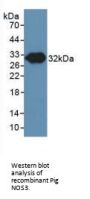 Nitric Oxide Synthase, Endothelial (NOS3) Antibody