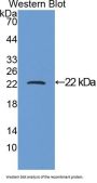 Parathyroid Hormone-Related Protein / PTHrP (PTHLH) Antibody