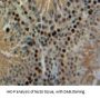 Parathyroid Hormone-Related Protein / PTHrP (PTHLH) Antibody