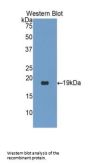 Procollagen C-Endopeptidase Enhancer 2 / PCPE2 (PCOLCE2) Antibody