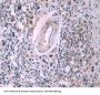 Secreted Frizzled Related Protein 4 (SFRP4) Antibody