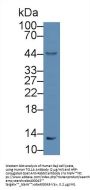 T-Cell Leukemia/Lymphoma Protein 1A (TCL1A) Antibody
