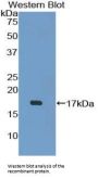 T-Cell Leukemia/lymphoma Protein 1A (TCL1A) Antibody