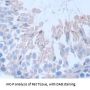 Fibrous Sheath Interacting Protein 1 (FSIP1) Antibody