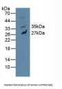 Mitogen-Activated Protein Kinase 10 / JNK3 (MAPK10) Antibody