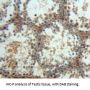 Mitogen-Activated Protein Kinase 10 / JNK3 (MAPK10) Antibody