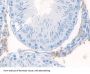 MEC Antibody