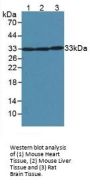 Superoxide Dismutase 2 (SOD2) Antibody