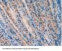 Superoxide Dismutase 2 (SOD2) Antibody