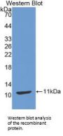 Thymus Activation Regulated Chemokine (TARC) Antibody