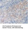Thymus Activation Regulated Chemokine (TARC) Antibody