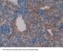 Transcription Factor A, Mitochondrial (TFAM) Antibody