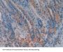 Transcription Factor A, Mitochondrial (TFAM) Antibody