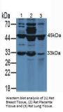 Vascular Endothelial Growth Factor A (VEGFA) Antibody