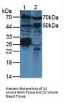 Vascular Endothelial Growth Factor C (VEGFC) Antibody