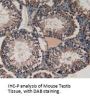 Vascular Endothelial Growth Factor C (VEGFC) Antibody