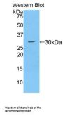 A Disintegrin And Metalloprotease 28 (ADAM28) Antibody