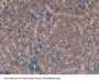 Alpha-1-Microglobulin / Bikunin Precursor (a1M) Antibody