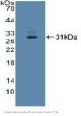 Interferon Gamma Inducible Protein 16 (IFI16) Antibody