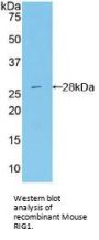 Antiviral Innate Immune Response Receptor RIG-I (RIGI) Antibody