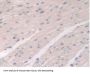 Antiviral Innate Immune Response Receptor RIG-I (RIGI) Antibody