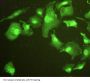Epithelial Cell Transforming Sequence 2 (ECT2) Antibody