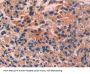 Epithelial Cell Transforming Sequence 2 (ECT2) Antibody