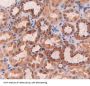 Epithelial Cell Transforming Sequence 2 (ECT2) Antibody