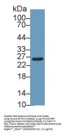 Glutathione S Transferase Mu 2, Muscle (GSTm2) Antibody