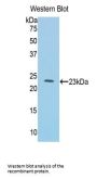 Interleukin 1 Receptor Like Protein 1 (IL1RL1) Antibody