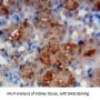Interleukin 1 Receptor Like Protein 1 (IL1RL1) Antibody
