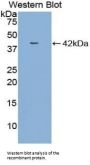 Macrophage Inflammatory Protein 1 Beta (MIP1b) Antibody