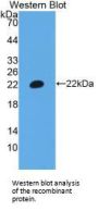 T-Cell Surface Glycoprotein CD3 Epsilon Chain (CD3E) Antibody