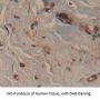 Fatty Acid Binding Protein 4, Adipocyte (FABP4) Antibody
