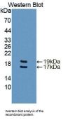 Fatty Acid Binding Protein 4, Adipocyte (FABP4) Antibody